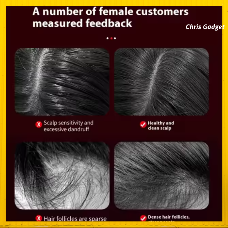 Masseur de tête électrique portable de relaxation du cuir chevelu